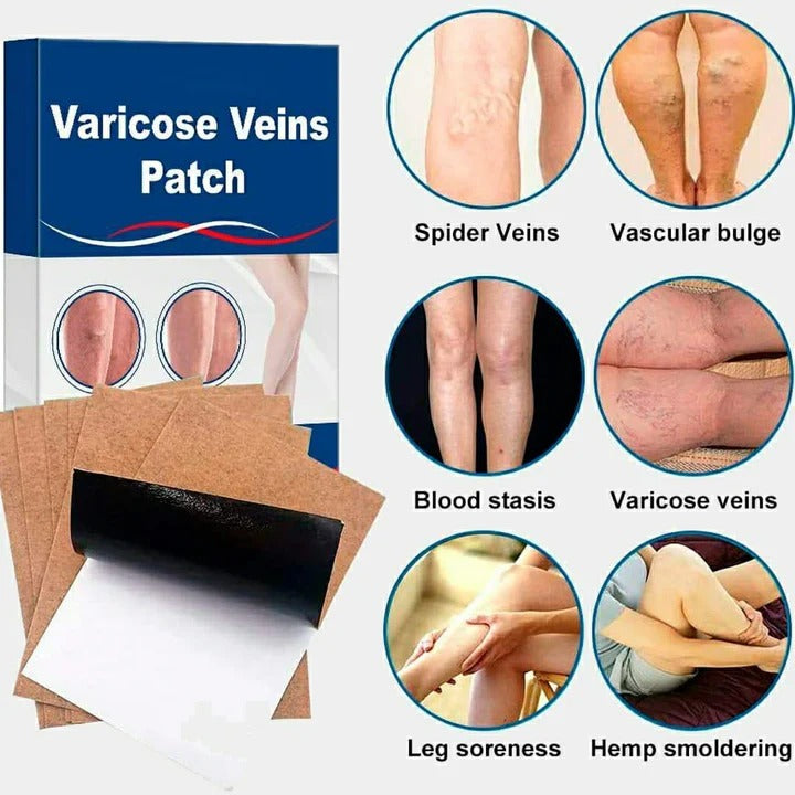 Clinically-Proven Varicose Veins Patch - 2 Pcs for Health and Wellness